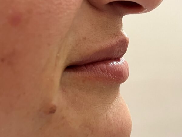 HYDRA LIPS - Imagen 4