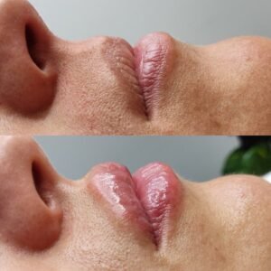 HYDRA LIPS