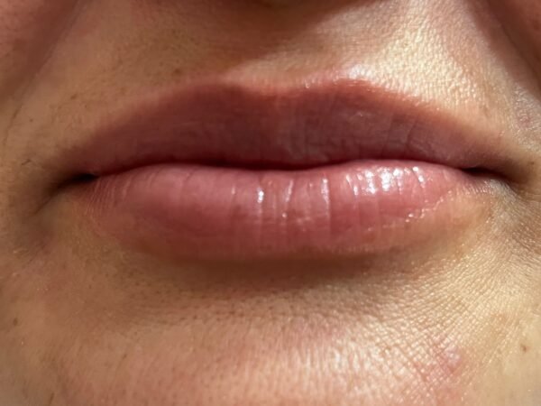 HYDRA LIPS - Imagen 2